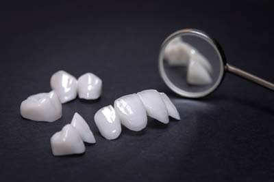 Improve Your Oral Health With A Dental Bridge