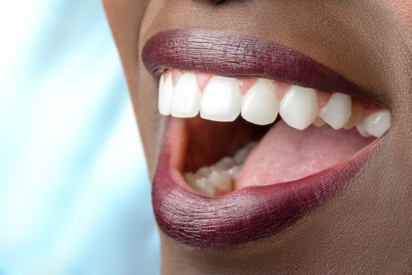 full mouth reconstruction Grand Blanc, MI