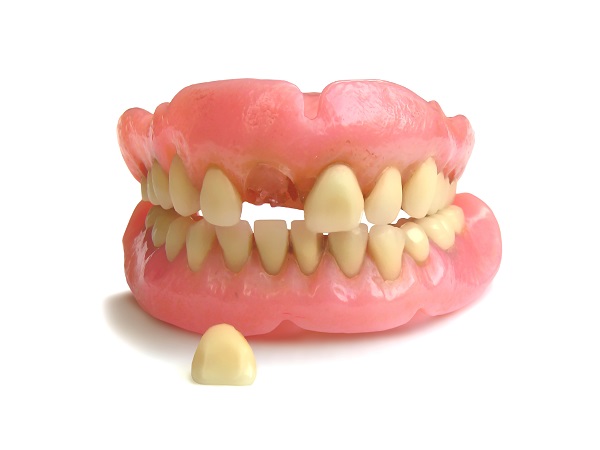 How Can A Cavity Lead To A Missing Tooth?