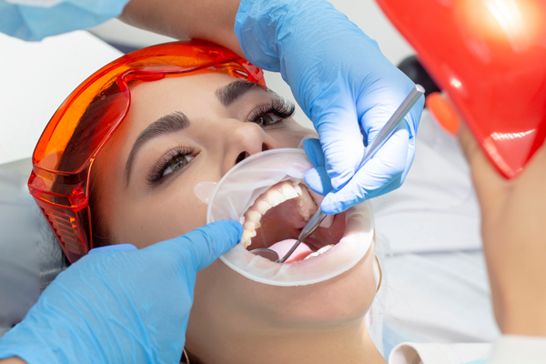 The Root Canal Process From A To Z