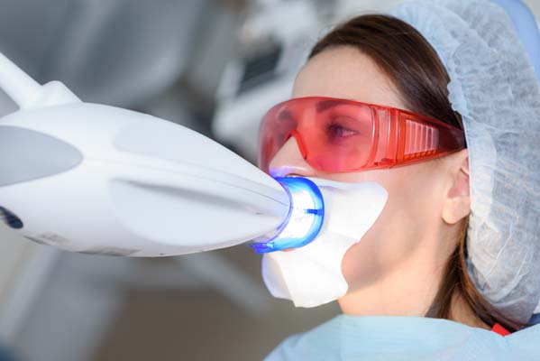 Tips For Professional Teeth Whitening